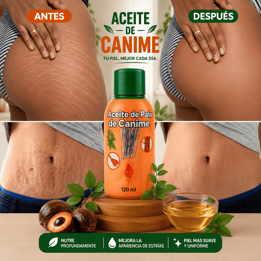 CANIME_ESTRIAS
