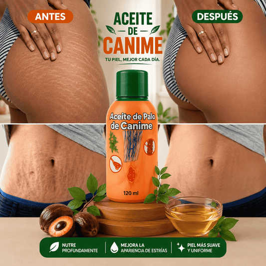 CANIME ESTRIAS