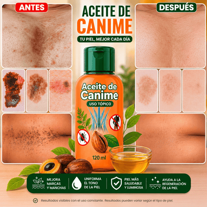 CANIME ESTRIAS
