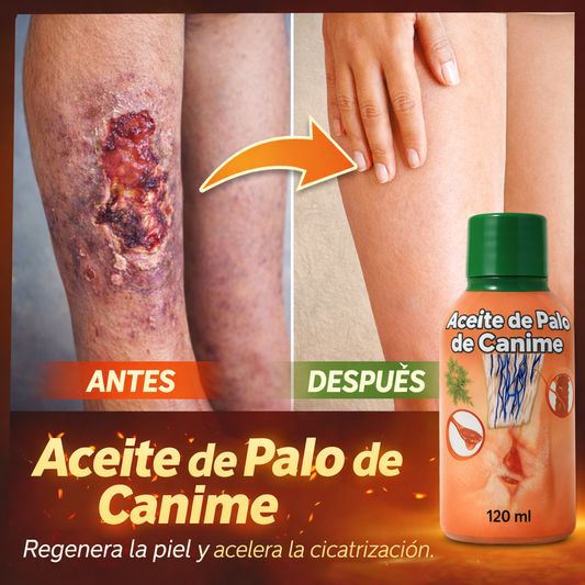 ACEITE DE PALO DE CANIME