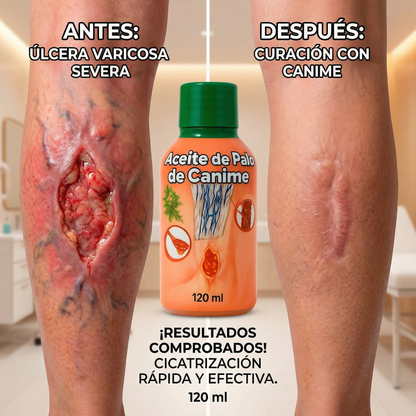 ACEITE DE PALO DE CANIME