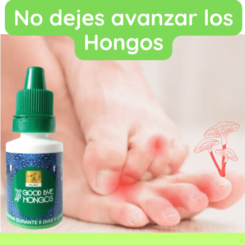 ANIQUILADOR DE HONGOS 100% NATURAL!